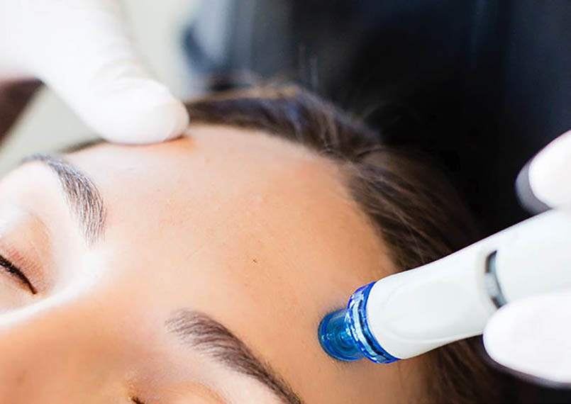 Hydrafacial