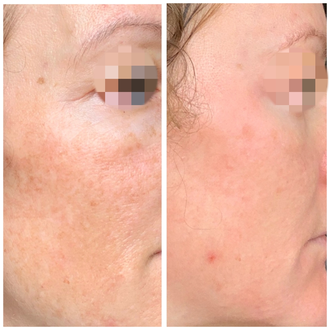 Medical Skincare Medical Skincare